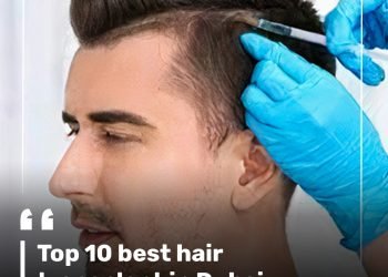 Top 10 best hair transplant in Dubai