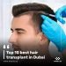 Top 10 best hair transplant in Dubai