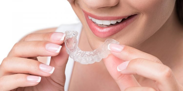 6 Amazing benefits of Invisalign that you never knew!