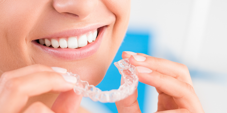 Invisalign Benefits The Complete Guide to Invisalign.