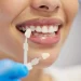 Comprehensive Guide to Finding the Best Dental Clinic in Coquitlam